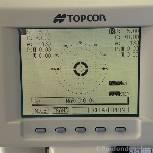 CL 100 CL 100 Computerized Lensmeter